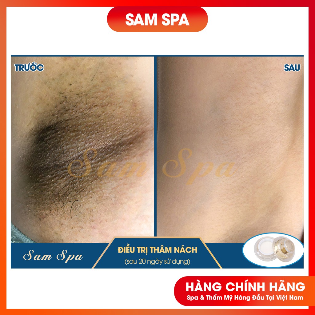 Kem Mờ Thâm Nách, Kem Mờ Thâm Bẹn Hàng Chuẩn Spa 30gr