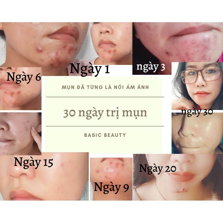 SERUM TRI MUN AN DOCTOR CARE-SERUM TRI MUN TRANG DA DOCTOR CẢRE | BigBuy360 - bigbuy360.vn