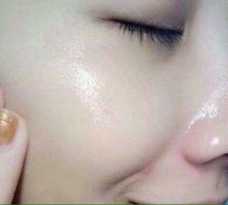 Serum 7 day.
