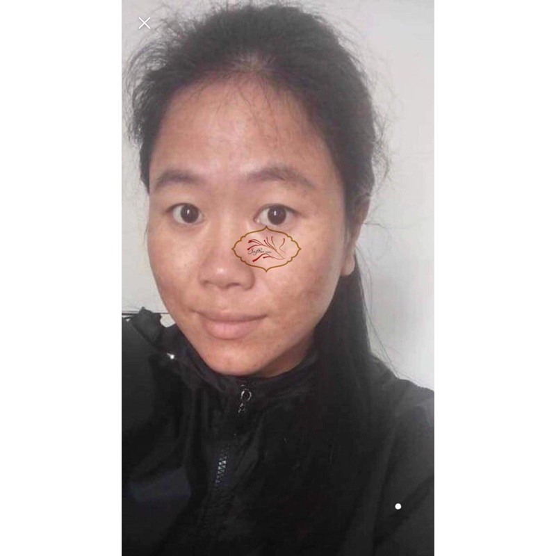 Kem Nám Melanin skin | BigBuy360 - bigbuy360.vn