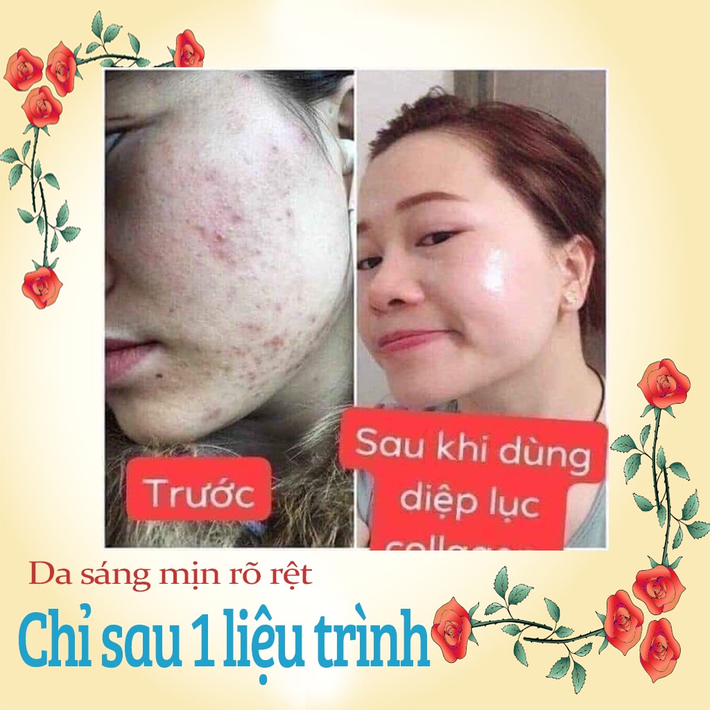 Diệp Lục Collagen Green Chính Hãng hỗ trợ Giảm Cân giảm mụn trắng da, ngăn ngừa lão hóa Hộp 30 Gói