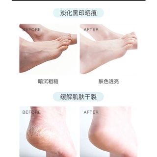 Mặt Nạ Tay Chân  Mèo Ú