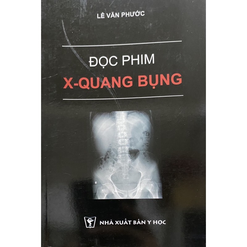 Sách -  Đọc phim x Quang Bụng