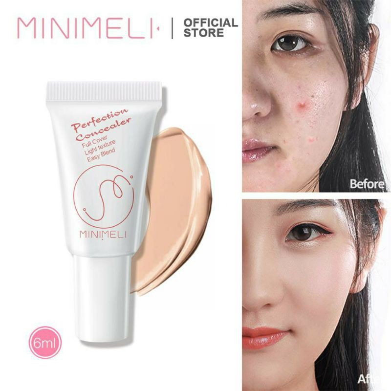 Kem che khuyết điểm minimeli
