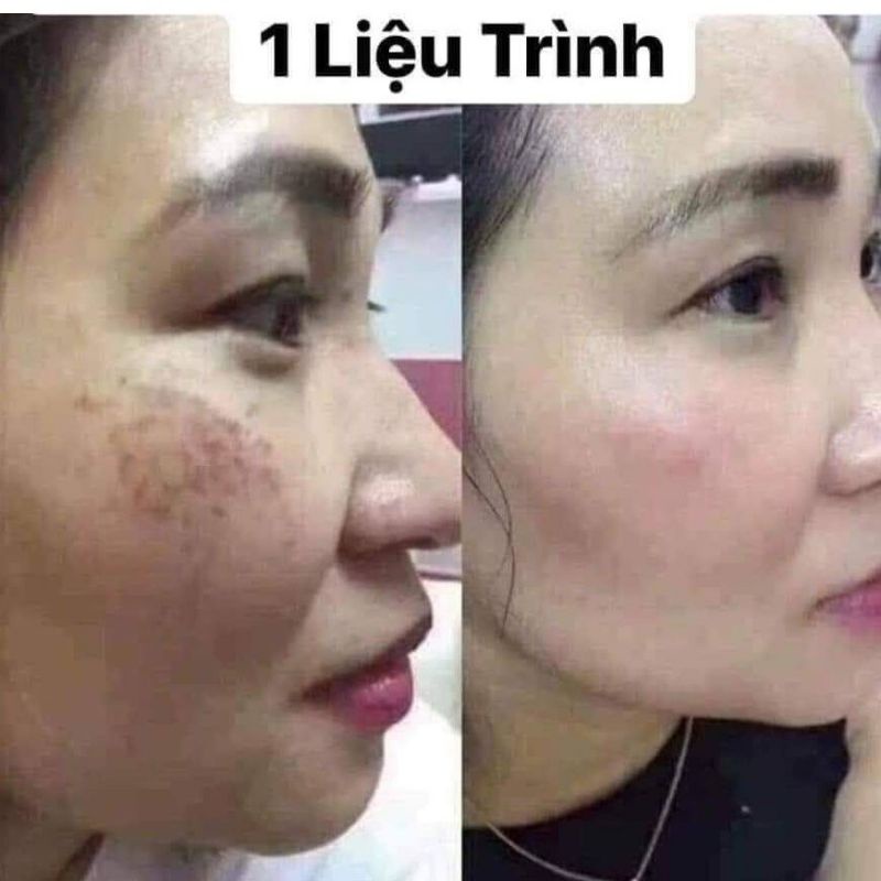 Viên Uống Trắng Da, Ngừa Nám Glutathione 600mg