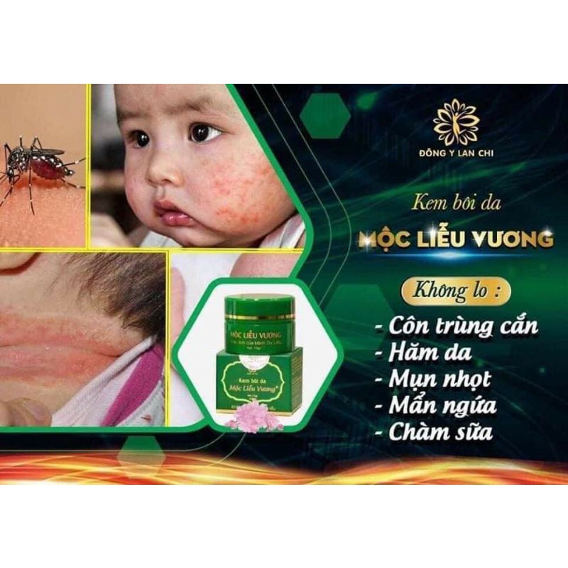 Kem bôi da Mộc liễu Vương_mẫu mới dạng tuyp tăng thêm 20% khối lượng