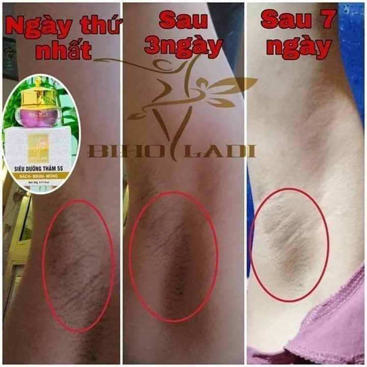 Siêu Dưỡng Thâm BIHOLADI [ cam kết chính hãng] | BigBuy360 - bigbuy360.vn