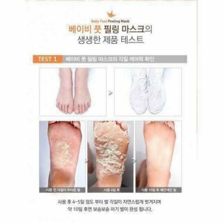 Ủ TẨY TẾ BÀO CHẾT CHÂN0