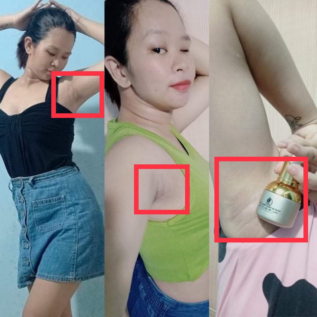 Serum Mờ Thâm Đầu Gối Khuỷu Tay Nách Môi Phúc Minh Tâm - Dưỡng Ẩm Mờ Thâm