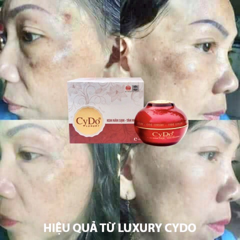 KEM MỜ NÁM SẠM TÀN NHANG 7 TÁC DỤNG CYDO LUXURY