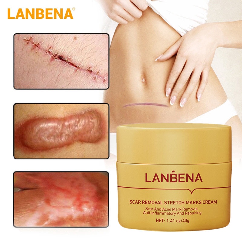 Bộ 3 Mỹ Phẩm LANBENA Serum/Gel/Kem Bôi Giúp Ngừa Mụn Đầu Đen/Mờ Sẹo/Phục Hồi Làn Da/Thu Hẹp Lỗ Chân Lông/Làm Trắng Da