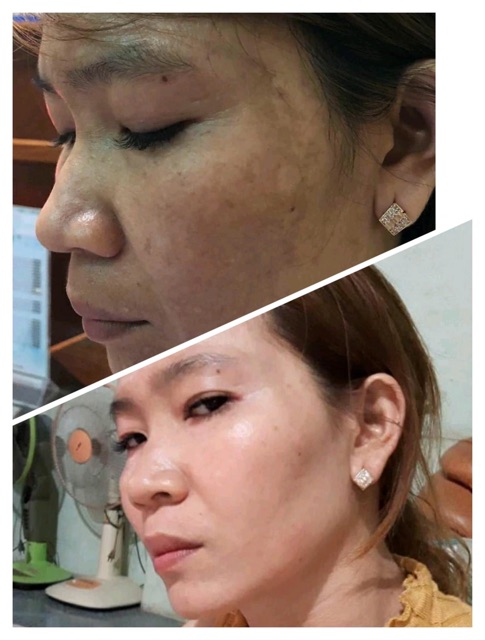 [HÀNG NHẬP KHẨU] Tinh chất làm mờ vết nám, hỗ trợ làm trắng da Jean D'Arcel Dermal Whitening Serum
