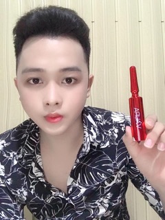 Cấy môi baby lips volume