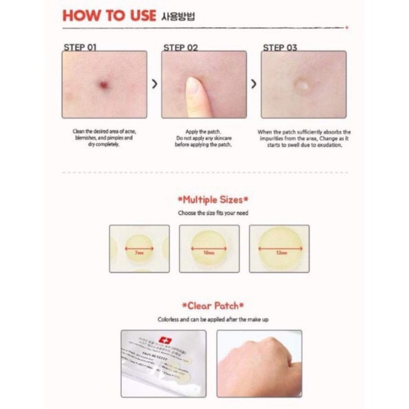 Miếng Dán Mụn Sưng Cosrx  Acne Pimple Master Patch Màu Đỏ & Clear Fit Master Patch Màu Đen