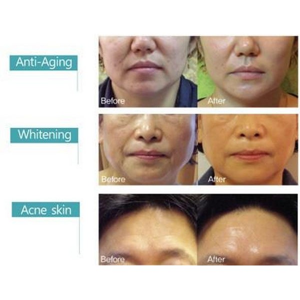 Thay da sinh học Matrigen B-TOX PEEL Hàn Quốc – 2 màu cho spa | BigBuy360 - bigbuy360.vn