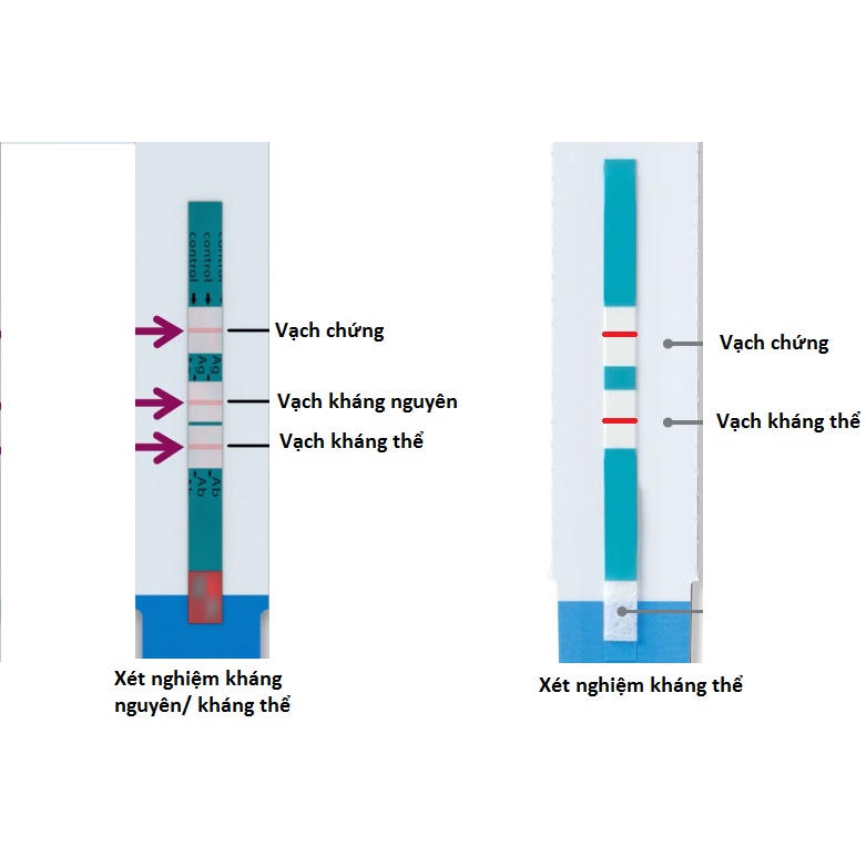 Bộ xét nghiệm HIV phát hiện sớm 14 ngày kết quả chính xác hơn 95%, ALERE COMBO Nhật Bản