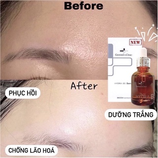 Serum cấp ẩm sáng da Goodndoc Hydra B5 30ml