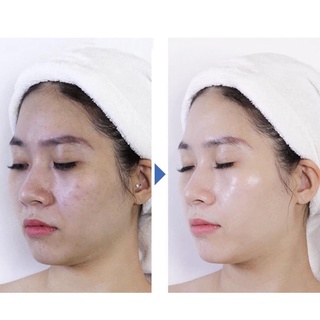 TẾ BÀO GỐC LAKSMIRA STEM CELL SOLUTION (1 ỐNG)