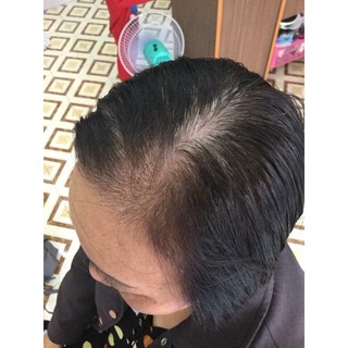 TÓC GIẢ mái dài che hói