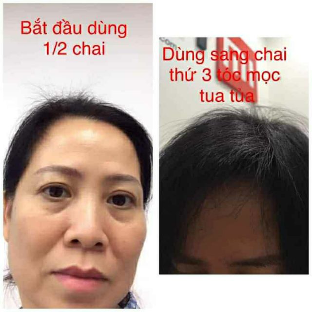 Xịt bưởi &amp; hương nhu kích mọc tóc mạnh