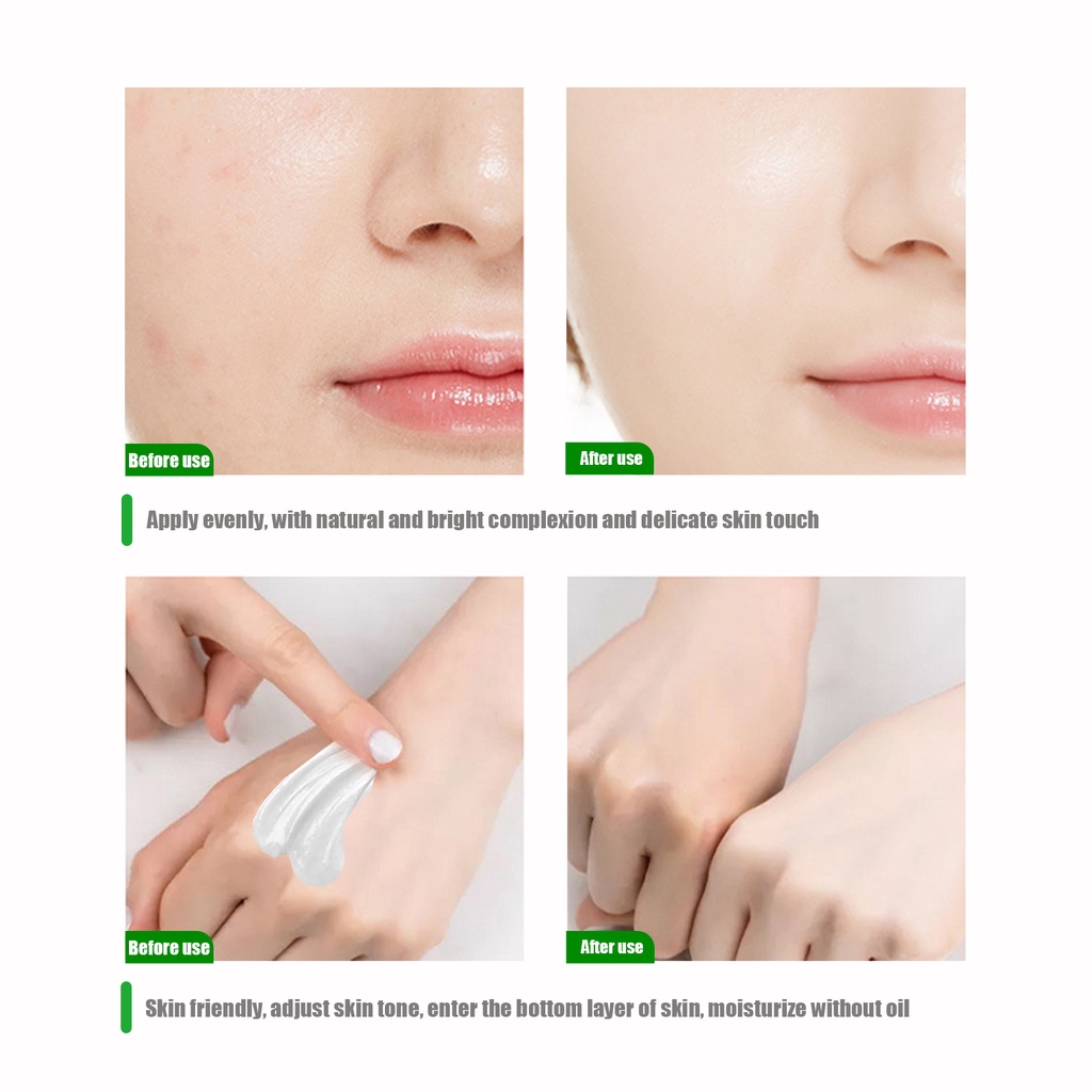 Kem Làm Trắng Vùng Da Dưới Cánh Tay / Đầu Gối / Mông Xóa Melanin Cải Thiện Sắc Tố Melanin Nu