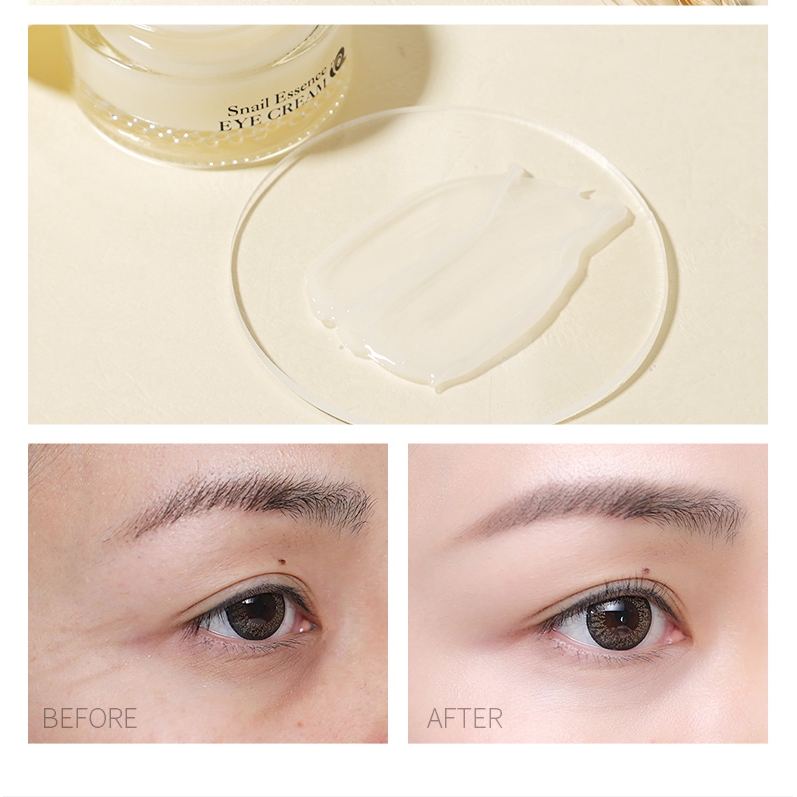 Kem Dưỡng Mắt Ốc Sên LAIKOU Xóa Quầng Thâm Bọng Mắt Chống Lão Hóa Chăm Sóc Mắt 25G