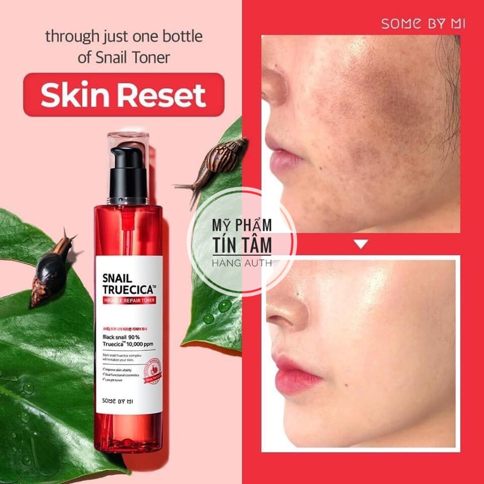 Nước Hoa Hồng Phục Hồi Da Some By Mi Snail Truecica Miracle Repair Toner 135ml