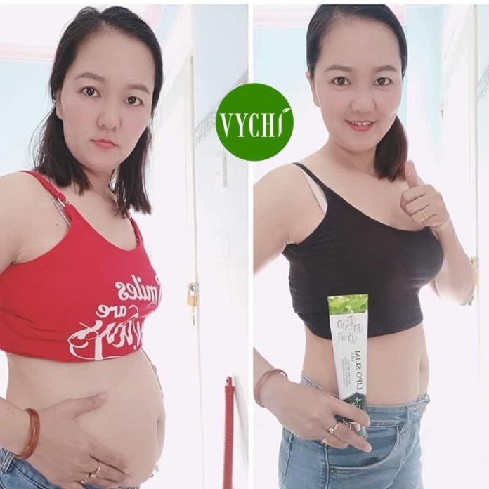 Gel tan mỡ/Kem tan mỡ - LIPO SLIM GEL VYCHI - giảm 3-5cm vòng bụng sau 1 TUẦN