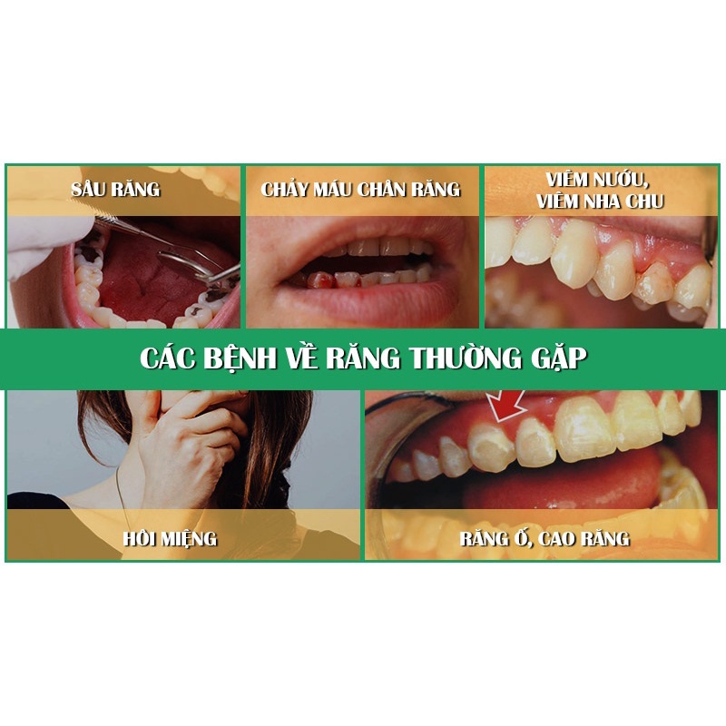 Kem đánh răng dược liệu NGỌC CHÂU 100g