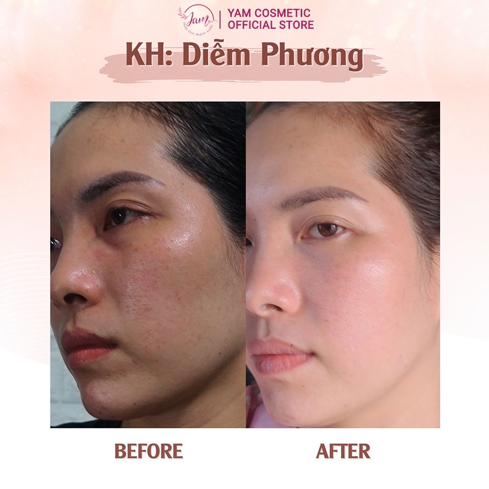 Bộ Dưỡng Trắng Sáng Da YAM Cosmetic Giúp Da Trắng Mờ Thâm Nám Hiệu Quả Serum 30ml Cream 30g