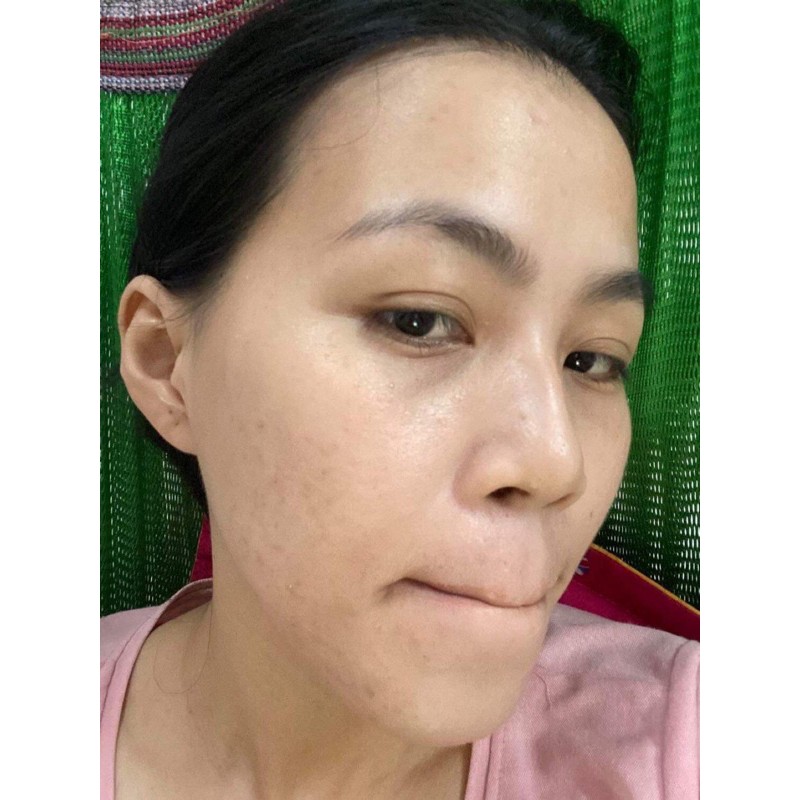 [SIZE 40ML] SERUM THANH DƯỢC - LÁRE THẢO DƯỢC ĐIỀU TRỊ DA | BigBuy360 - bigbuy360.vn