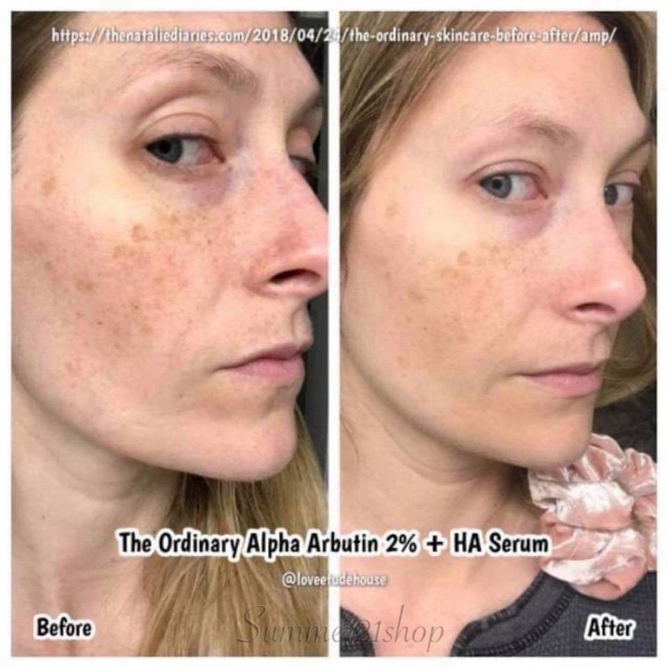 Tinh Chất Dưỡng Trắng, Cấp Nước The Ordinary Alpha Arbutin 2% + HA 30ml