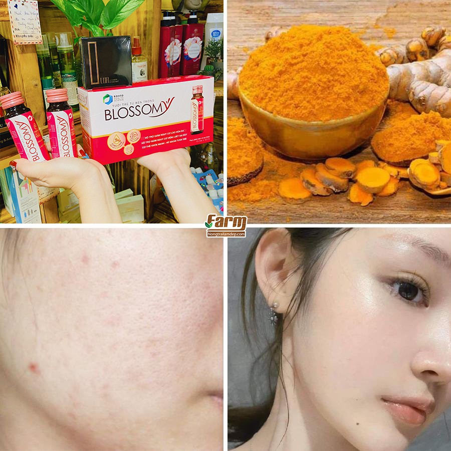 Lốc 10 chai x 50ml Nước Uống Đẹp Da, Cải Thiện Sức Khỏe Blossomy + Tặng Hộp Xếp Blossomy | BigBuy360 - bigbuy360.vn