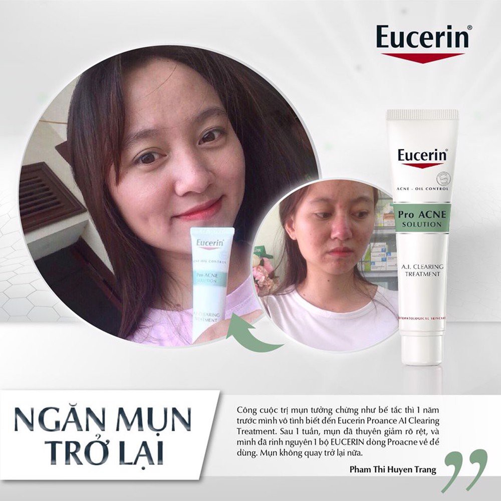 (CHÍNH HÃNG) Tinh Chất Eucerin Giảm Mụn Viêm, Mờ Vết Thâm 40ml Pro ACNE Solution A.I Clearing Treatment