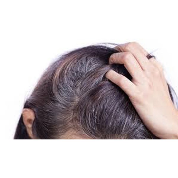 Dầu gội thảo dược Haco 300ml-ngăn ngừa rụng tóc, kích thích sự phát triển của nang tóc/Hàng chính hãng | BigBuy360 - bigbuy360.vn