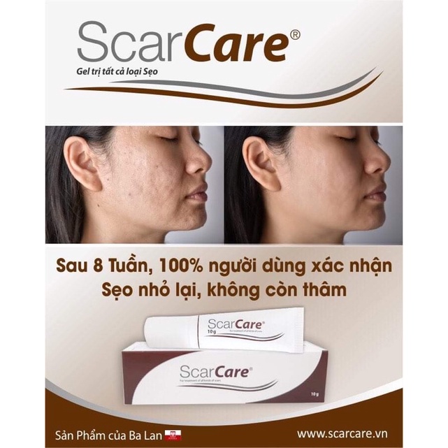 Gel bôi sẹo scarcare 10g (Ba Lan) sau phẫu thuật, sau chấn thương,do bỏng,do mụn,sẹo phì đại,sẹo lồi,rạn da,xoá hình xăm