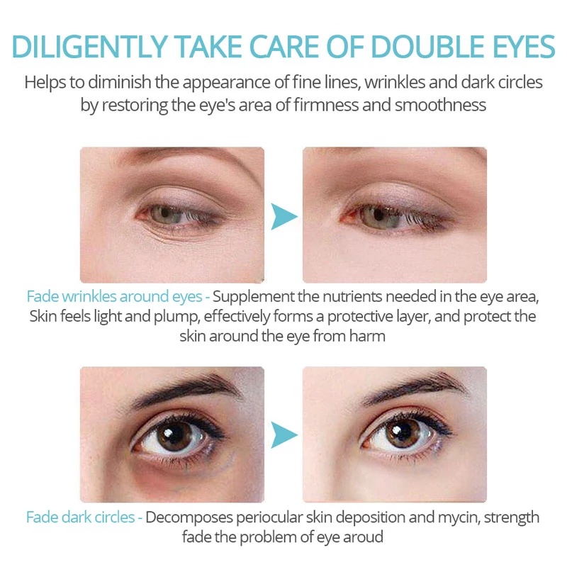 [Hàng mới về] Kem dưỡng da mắt VOVA 2.5% Retinol hoạt tính ngăn ngừa nếp nhăn làm giảm vết nứt nẻ