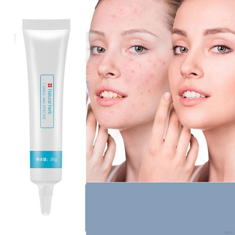 [Hàng mới về] Kem Giảm Mụn Dưỡng Ẩm Thu Nhỏ Lỗ Chân Lông Làm Săn Chắc Da 20g