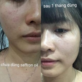 Com bo 2 lọ Saffron oil [Hàng chuẩn nhập khẩu]