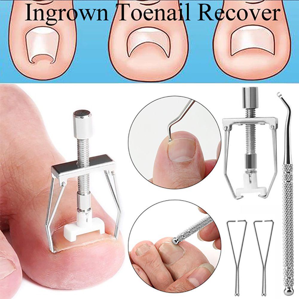Dụng Cụ Chỉnh Hình Móng Chân Mọc Ngược Bằng Ngà Voi