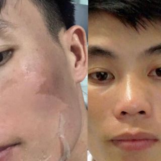 Serum Tái Tạo Trắng Da