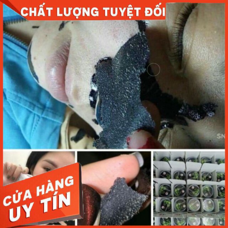 Gel hút mụn than tre hoạt tính Lê Thanh[ CHÍNH HÃNG], gel lột mụn