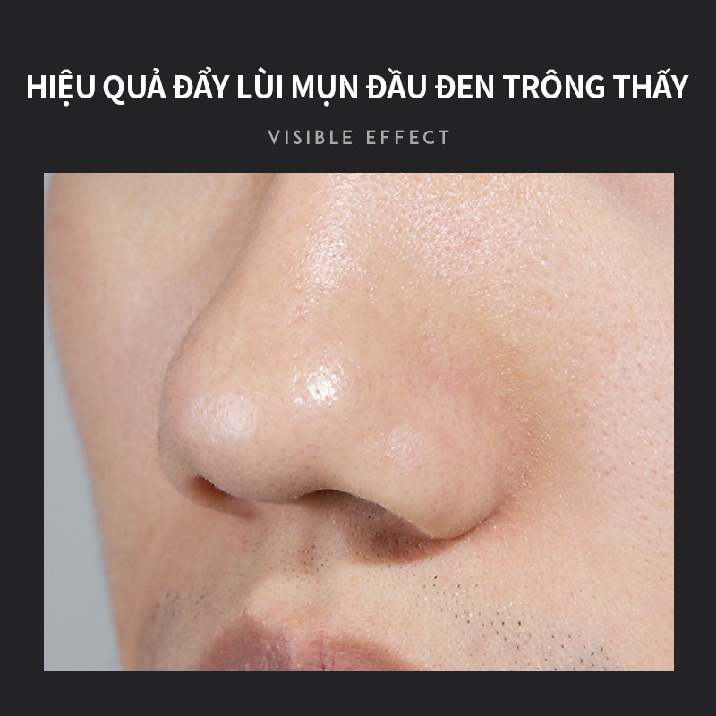 Bộ Sản Phẩm Tẩy Mụn Đầu Đen BAIMISS 180g Làm Sạch Và Se Lỗ Chân Lông | BigBuy360 - bigbuy360.vn