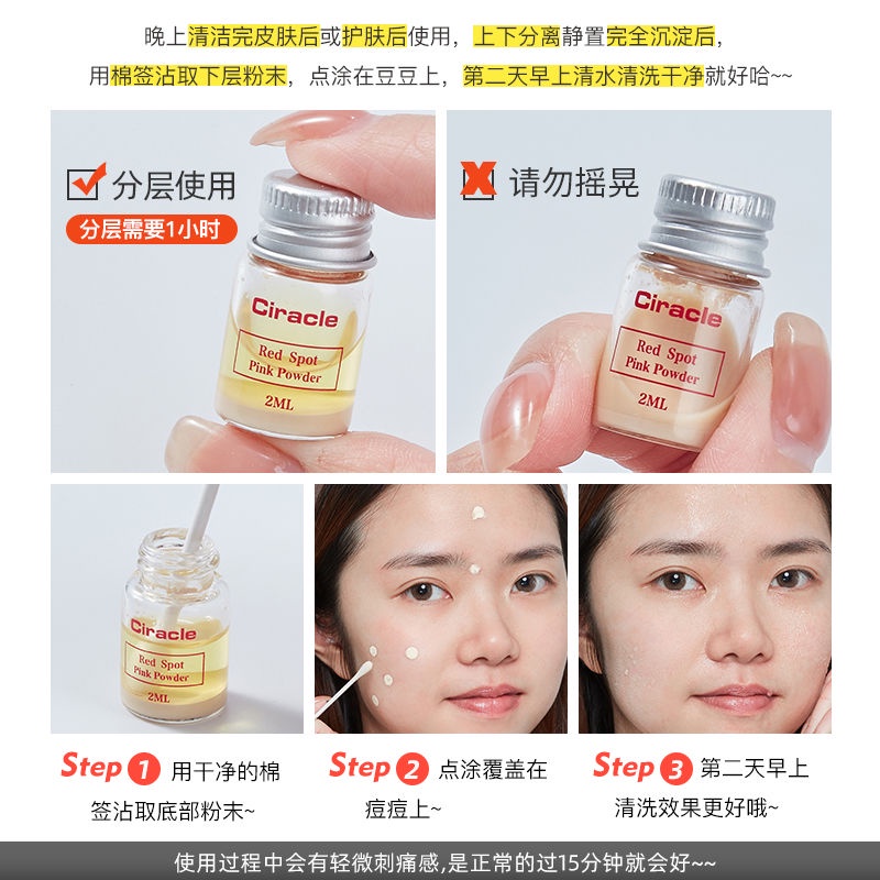 Kem hỗ trợ giảm mụn trứng cá 21 vùng da khôi phục phục hồi làn da hiệu quả qiaoshusheng.11.3 | BigBuy360 - bigbuy360.vn