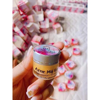 Kem Mụn Acne Mỹ Lyn ( hủ 5g và 10gr ) kèm quà