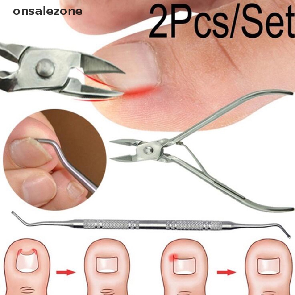 2 dụng cụ kìm cắt chăm sóc điều chỉnh móng chân mọc ngược