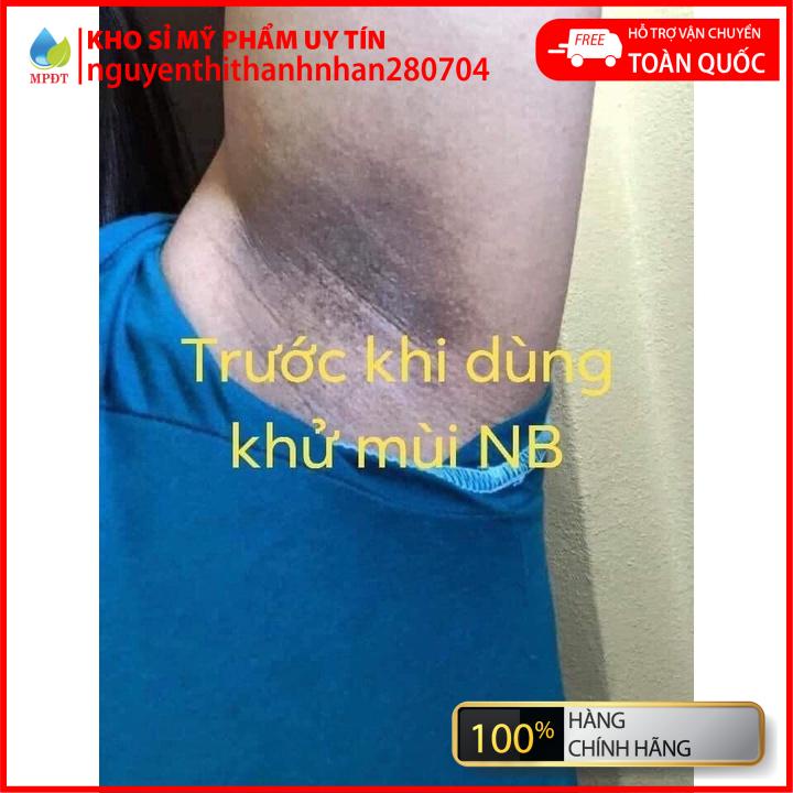 (chính hãng) Thảo dược khử mùi hôi nách hồng, khử mùi hôi nách hôi chân, khử thâm nách, đen nách, se lỗ chân lông hàng m