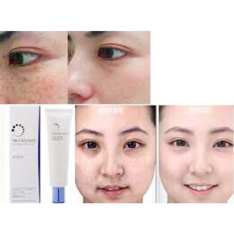 Serum Ngăn ngừa Nám và giúp giảm nám,Trắng Da Transino Whitening Essence EX 50g.