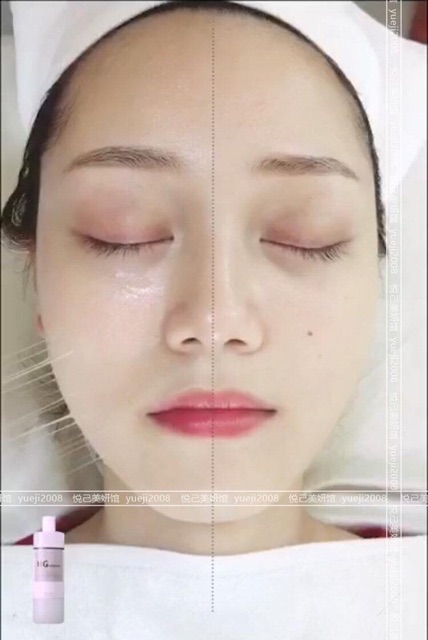 HG collagen Nhau Thai Tươi Hàn Quốc - Tinh Chất Collagen Điện Di căng bóng