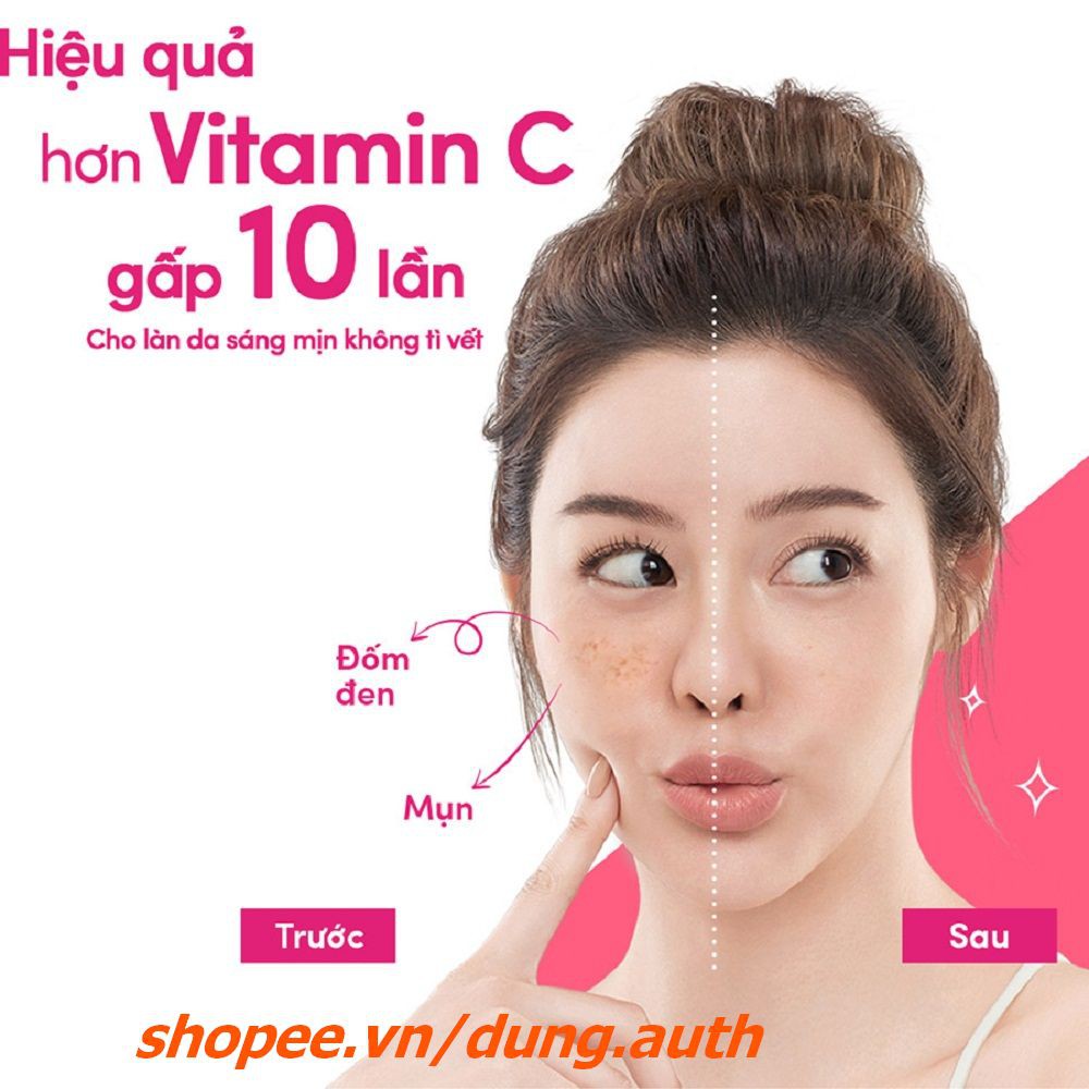 Kem dưỡng trắng da Ponds 50g hồng rạng rỡ ban ngày White Beauty